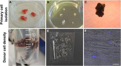 Physiological cell bioprinting density in human bone-derived cell-laden scaffolds enhances matrix mineralization rate and stiffness under dynamic loading